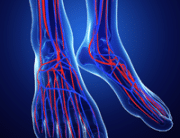 critical limb ischemia represented by 2 feet displaying the veins and arteries with red and blue animation